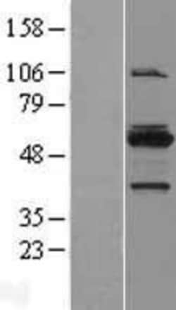 Novus Biologicals&trade;&nbsp;MYBPH Overexpression Lysate