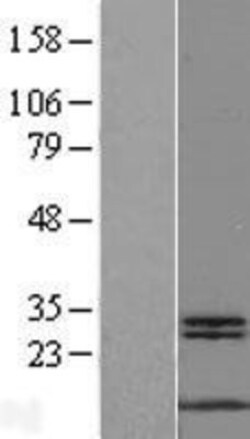 Novus Biologicals&trade;&nbsp;MYCBP Overexpression Lysate