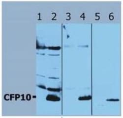 Mycobacterium Tuberculosis CFP10 Antibody - BSA Free, Novus Biologicals