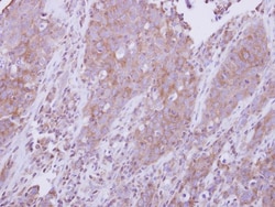MyD88 Antibody, Novus Biologicals 0.1mL; Unlabeled:Antibodies, Polyclonal