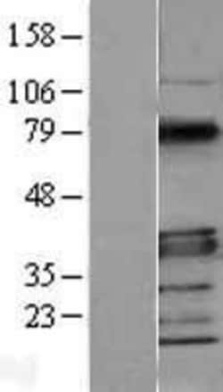 Novus Biologicals&trade;&nbsp;MyD88 Overexpression Lysate
