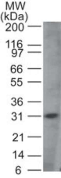 MyD88 Antibody, Novus Biologicals 0.025mg; Unlabeled:Antibodies, Polyclonal