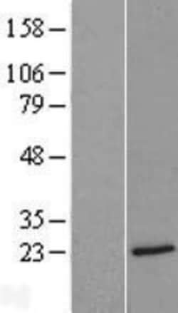 Novus Biologicals&trade;&nbsp;MBP Overexpression Lysate