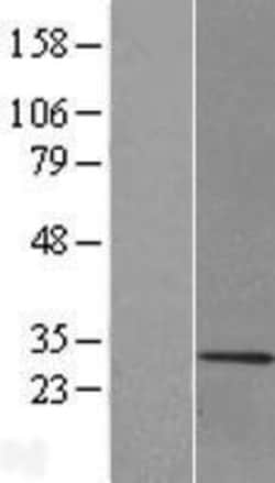 Novus Biologicals™ MBP Overexpression Lysate