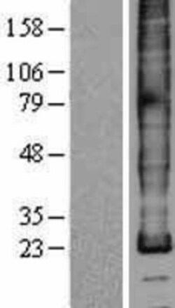 Novus Biologicals™ Myelin PLP Overexpression Lysate