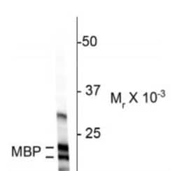 MBP Antibody, Novus Biologicals 0.1 mL | Buy Online | Novus Biologicals | Fisher Scientific