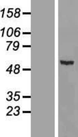 Novus Biologicals&trade;&nbsp;MYH Overexpression Lysate