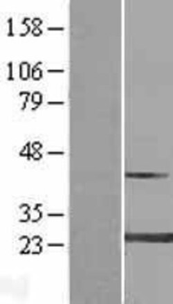 Novus Biologicals&trade;&nbsp;MYL4 Overexpression Lysate