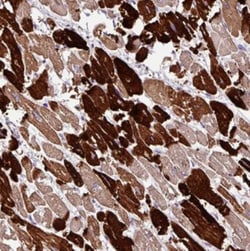 MYL4 Antibody, Novus Biologicals 0.1mL; Unlabeled:Antibodies, Polyclonal