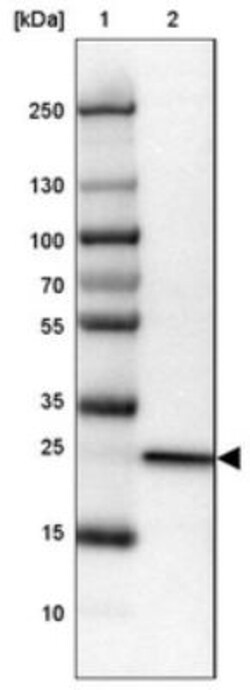 MYL4 Antibody, Novus Biologicals 0.1mL; Unlabeled:Antibodies, Polyclonal
