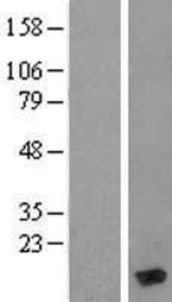 Novus Biologicals&trade;&nbsp;MYL6 Overexpression Lysate