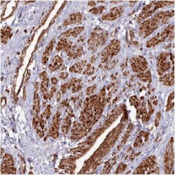 MYL6 Antibody, Novus Biologicals:Antibodies:Primary Antibodies