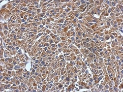 MYL7 Antibody, Novus Biologicals 0.1mL; Unlabeled:Antibodies, Polyclonal