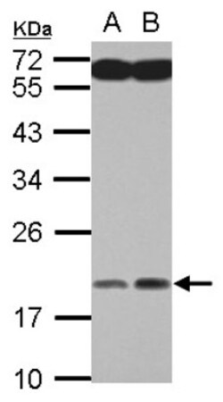MYL7 Antibody, Novus Biologicals 0.1mL; Unlabeled:Antibodies, Polyclonal