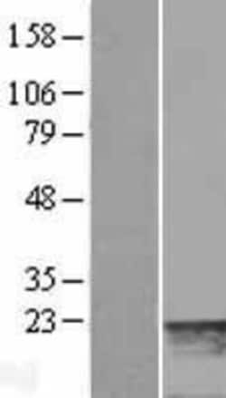 Novus Biologicals&trade;&nbsp;MYL7 Overexpression Lysate