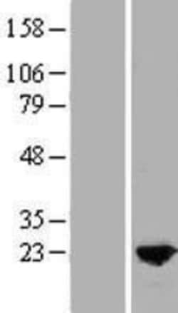 Novus Biologicals&trade;&nbsp;MYL9 Overexpression Lysate