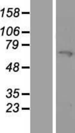 Novus Biologicals&trade;&nbsp;MYLK2 Overexpression Lysate