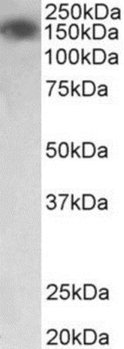 MYLK2 Antibody, Novus Biologicals 0.1mg; Unlabeled:Antibodies, Polyclonal