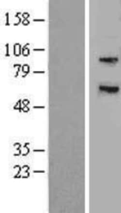 Novus Biologicals&trade;&nbsp;MYLK3 Overexpression Lysate