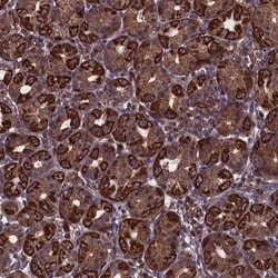 MYO1H Antibody, Novus Biologicals 0.1mL; Unlabeled:Antibodies, Polyclonal