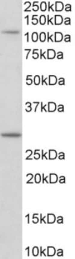 MYO1H Antibody, Novus Biologicals 0.1mg; Unlabeled:Antibodies, Polyclonal