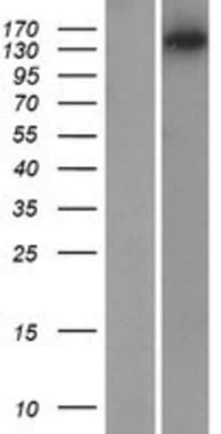 Novus Biologicals&trade;&nbsp;MYO3B Overexpression Lysate