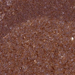 MYO9B Antibody, Novus Biologicals 25 &mu;L; Unlabeled:Antibodies, Polyclonal