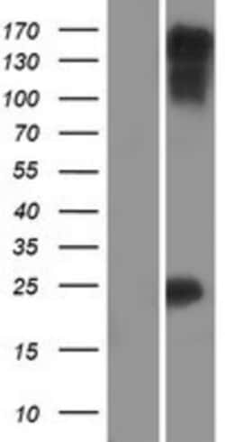 Novus Biologicals&trade;&nbsp;Myocardin Overexpression Lysate