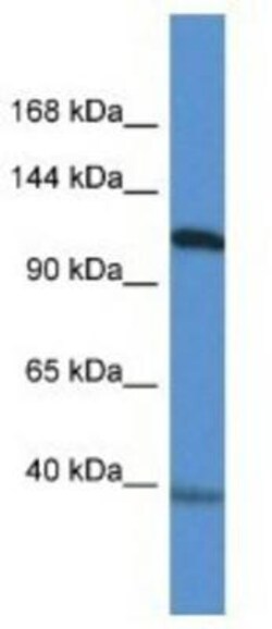 Myocardin Antibody, Novus Biologicals 100μL; Unlabeled:Antibodies, Polyclonal