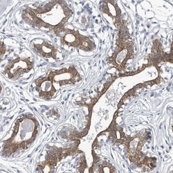 Myocilin Antibody, Novus Biologicals:Antibodies:Primary Antibodies