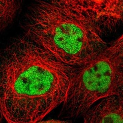 CLIP170 Antibody, Novus Biologicals:Antibodies:Primary Antibodies