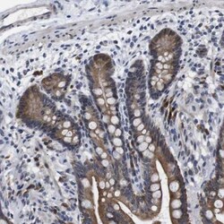 CLIP170 Antibody, Novus Biologicals:Antibodies:Primary Antibodies