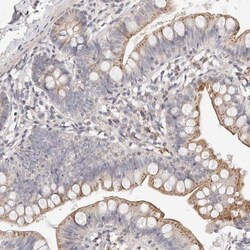 MYOM3 Antibody, Novus Biologicals:Antibodies:Primary Antibodies