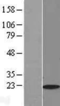Novus Biologicals&trade;&nbsp;Myosin Light Chain 2 Overexpression Lysate