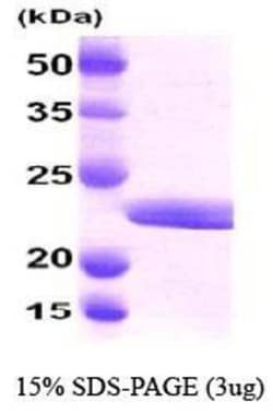 Novus Biologicals Recombinant Human Myosin Light Chain 2 His Protein 0.1mg; Unlabeled | Buy Online | Novus Biologicals&trade; | Fisher Scientific
