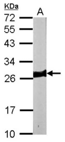 Myosin light chain 3 Antibody, Novus Biologicals 0.1mL; Unlabeled:Antikörper