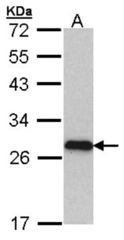 Myosin light chain 3 Antibody, Novus Biologicals 0.1mL; Unlabeled:Antikörper