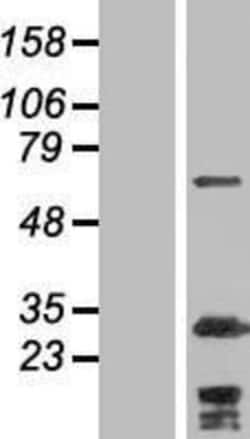Novus Biologicals&trade;&nbsp;Myosin Phosphatase 2 Overexpression Lysate