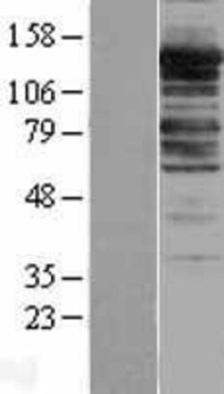 Novus Biologicals&trade;&nbsp;Myosin Phosphatase Overexpression Lysate