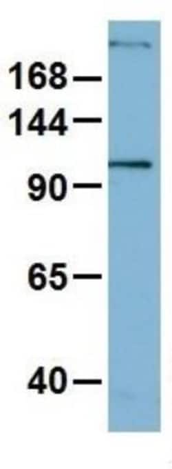 Myosin Heavy Chain 1 Antibody, Novus Biologicals 0.05mg; Unlabeled:Antibodies,