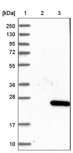 Myosin Light Chain 2 Antibody, Novus Biologicals 25 &mu;L; Unlabeled:Antibodies,