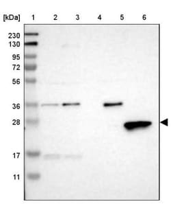 Myosin light chain 3 Antibody, Novus Biologicals:Antibodies:Primary Antibodies