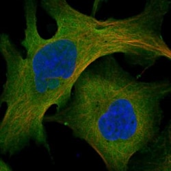 myosin X Antibody, Novus Biologicals 25 &mu;L; Unlabeled:Antibodies, Polyclonal