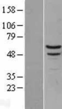 Novus Biologicals&trade;&nbsp;Myotilin Overexpression Lysate
