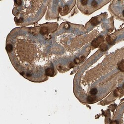 Myotubularin Antibody, Novus Biologicals:Antibodies:Primary Antibodies