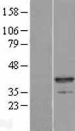 Novus Biologicals&trade;&nbsp;Myozenin 1 Overexpression Lysate