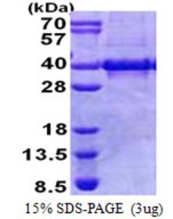 Novus Biologicals&trade;&nbsp;Recombinant Human Myozenin 1 His Protein