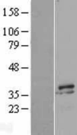 Novus Biologicals&trade;&nbsp;Myozenin 2 Overexpression Lysate