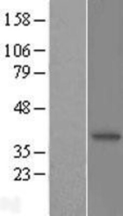Novus Biologicals&trade;&nbsp;N myc interactor Overexpression Lysate