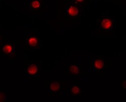 N4BP1 Antibody - BSA Free, Novus Biologicals 0.1mg; Unlabeled:Antibodies,